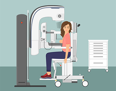 Mammography (for animation)
