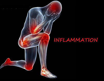 Inflammatory Disease Therapy