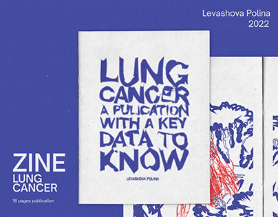 ZINE — Lung Cancer