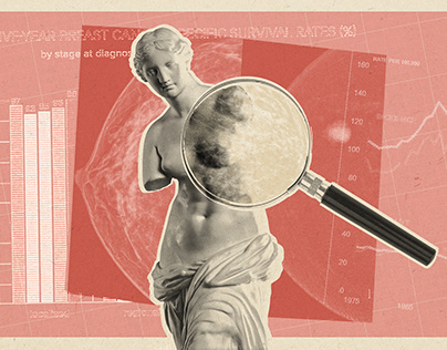 Editorial Collage I Mammogram