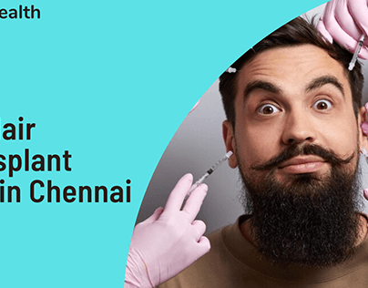 Exploring DHI Hair Transplant Cost in Chennai