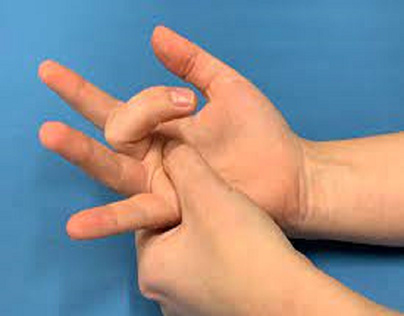 Practice Home Remedies for Trigger Finger
