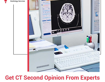 Get CT Second Opinion From Experts