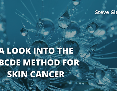 A Look into the ABCDE Method for Skin Cancer