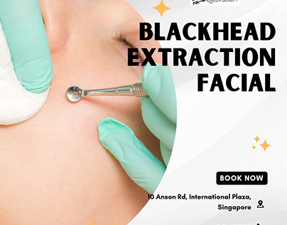 the benefits of blackhead extraction facials