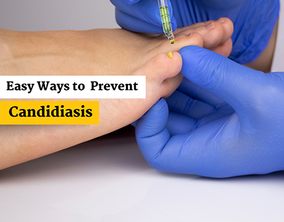 Easy Ways to Prevent Candidiasis