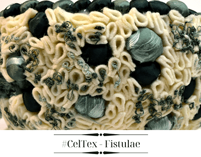 #CelTex - Fistulae