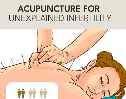 Acupuncture for Unexplained Infertility