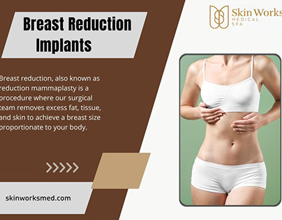 Breast Reduction Implants