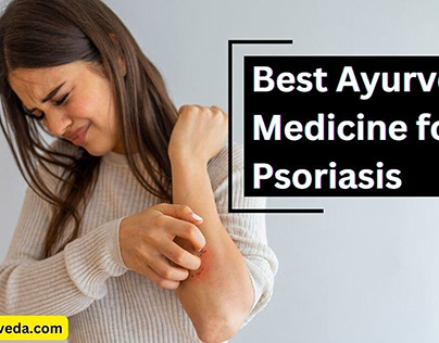 Best Ayurvedic Medicine for Psoriasis