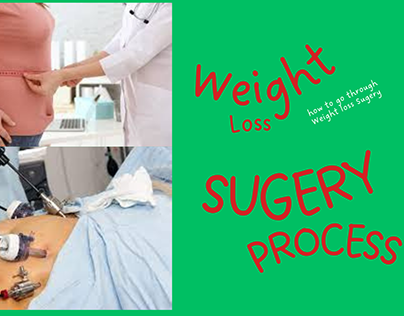 Type of Weight loss Surgery