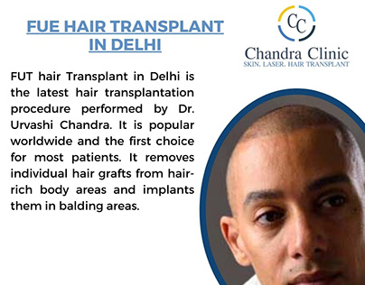 Why do people choose FUE hair transplantation?