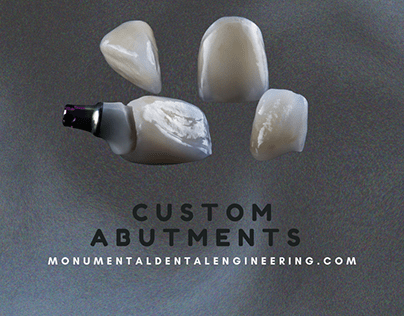 Custom fabricated abutments