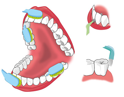 Ilustrace čištění zubů/Illustration of teeth cleaning