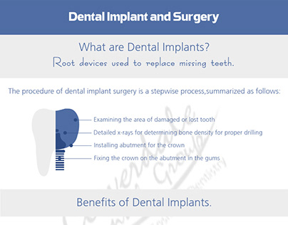 Dental Implant and Surgery