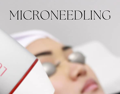Microneedling - Treatments and Benefits
