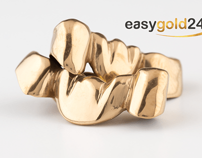 Easygold24: Zahngold Online zum Bestpreis verkaufen