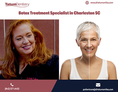 Botox Treatment Specialist in Charleston SC