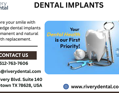 Make Your Smile Beautiful with Advanced Dental Implants
