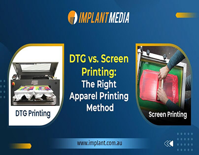 DTG vs. Screen Printing