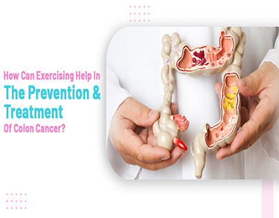 Colon Cancer Prevention And Treatment