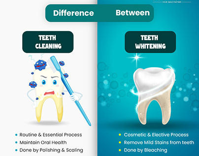 Tooth Whitening Services in Hyderabad - ALIVIO