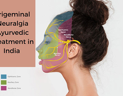 Trigeminal Neuralgia Ayurvedic Treatment in India