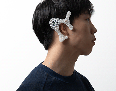 Bone conduction prosthetic ear