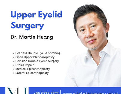 Upper Eyelid Surgery - Dr. Martin Huang
