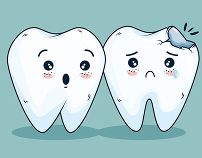 Cracked Teeth: Prevention and Treatment