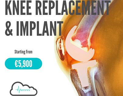 Knee Replacement Implant at Cloudsmetics