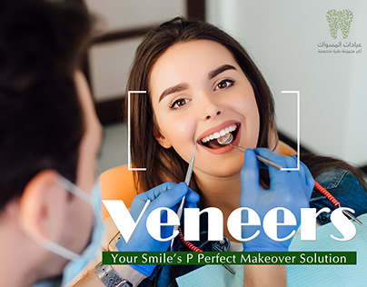 Teeth Veneers