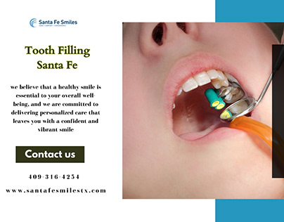 Tooth Filling in Santa Fe