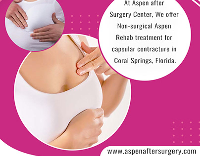 Capsular Contracture Treatment in Coral Springs Florida