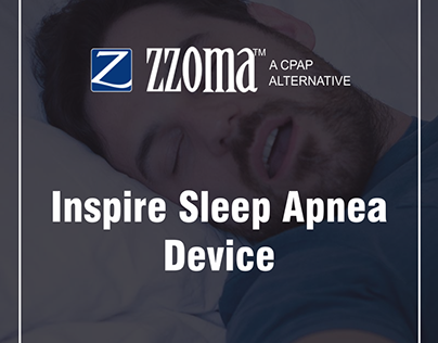 Inspire Sleep Apnea Device