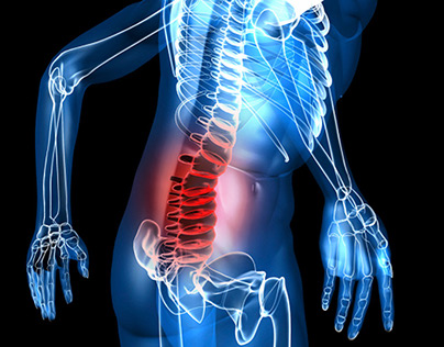 Chronic spine pain
