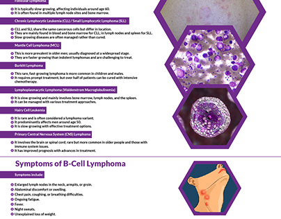 Types of B-Cell Lymphoma: Symptoms & Treatment Guide