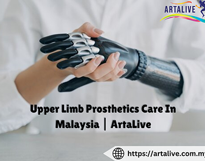 Upper Limb Prosthetics Care In Malaysia | ArtaLive