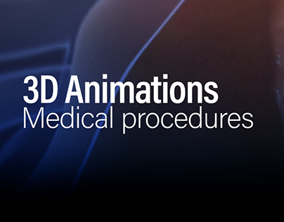Laparoscopy Procedures: 3D Animation Showcase