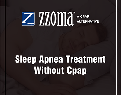 Sleep Apnea Treatment Without Cpap