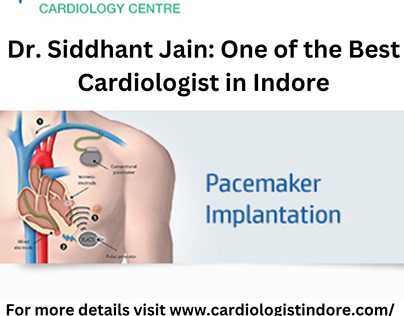 Your Heart's Ally: Dr. Sidhant Cardiologist in Indore