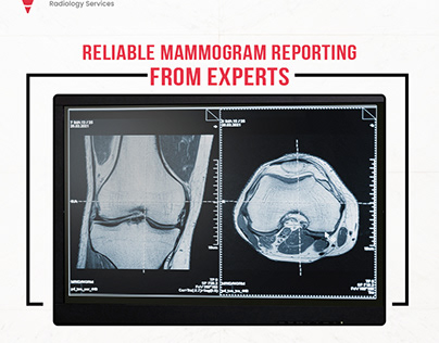 Reliable Mammogram Reporting from Experts