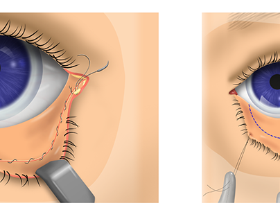 Medical Eye Illustration