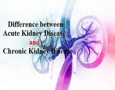 Difference Between Acute and Chronic Kidney Disease