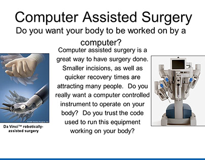 Atlas Medical on Computer Aided Surgery Systems
