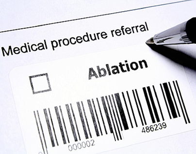 What To Expect From An Ablation Procedure