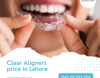 Clear Aligners price in Lahore