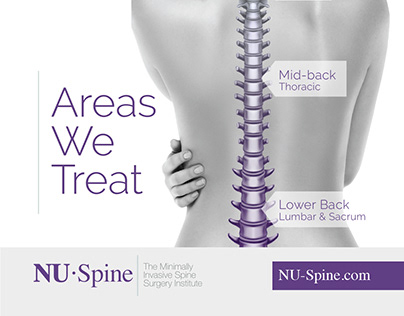 Spinal Deformity Surgery Correction & Stabilization