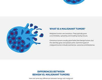 Benign vs Malignant Tumors Understanding Differences