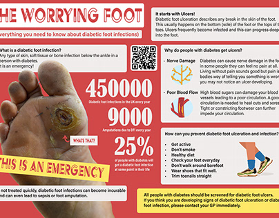The Worrying Foot